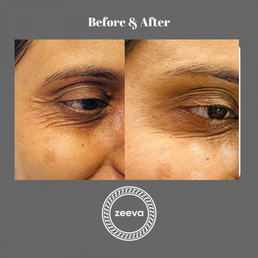 Slider image (5) Zeeva Skin & Hair Clinic